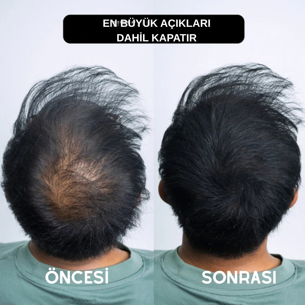 SilvaHair Saç Sakal Dolgunlaştırıcı