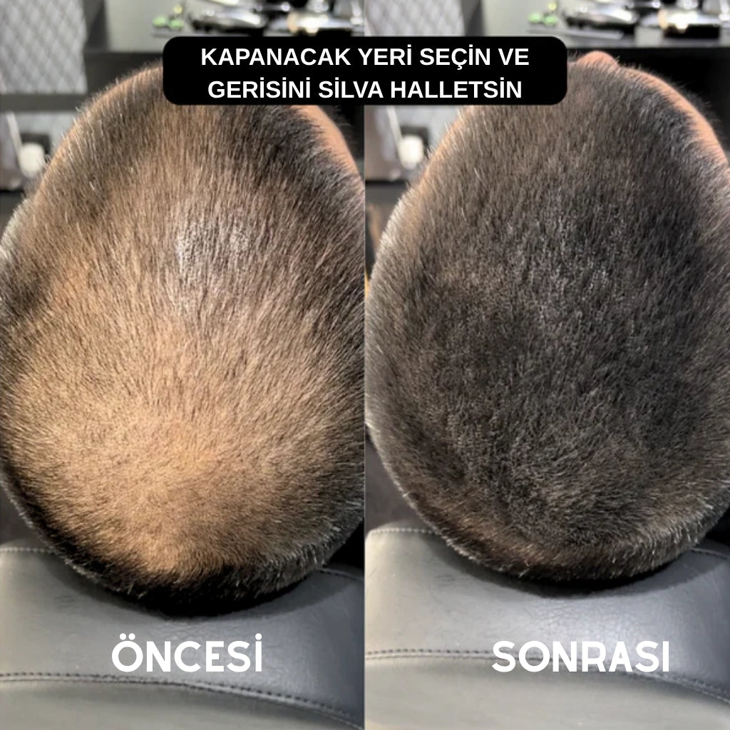 SilvaHair Saç Sakal Dolgunlaştırıcı